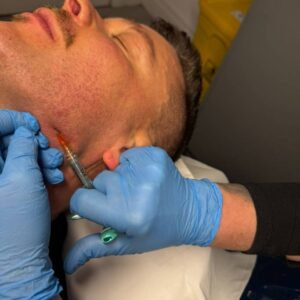Advanced Fillers