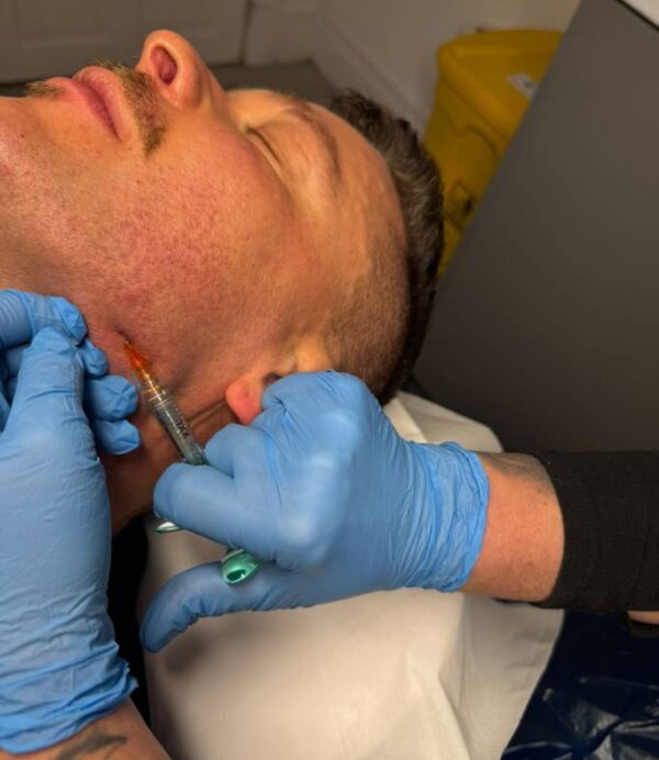 Advanced Fillers